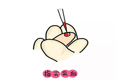 儿童一区二区三区国产传媒麻豆微量元素的检测项目有哪些