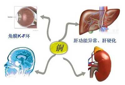 人体麻豆视频三级片数据能够准检测出但身体中微量元素铜超标会引起疾病发生